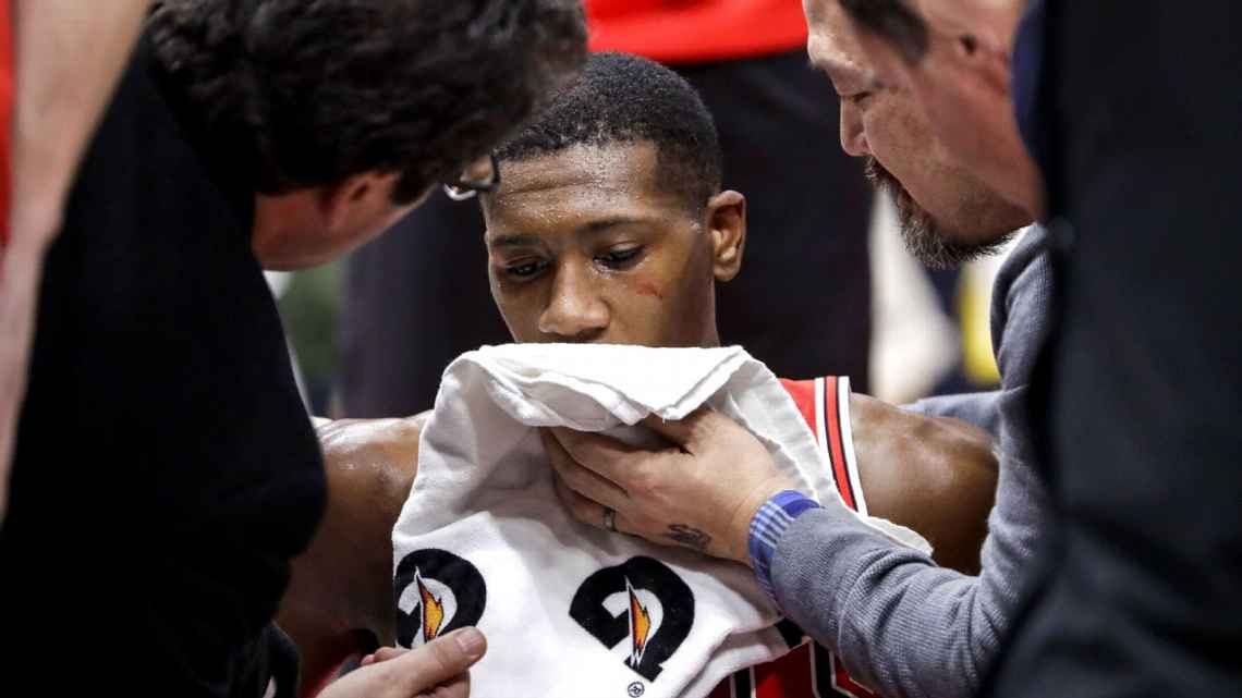 Bulls' Dunn returning after 11game absence