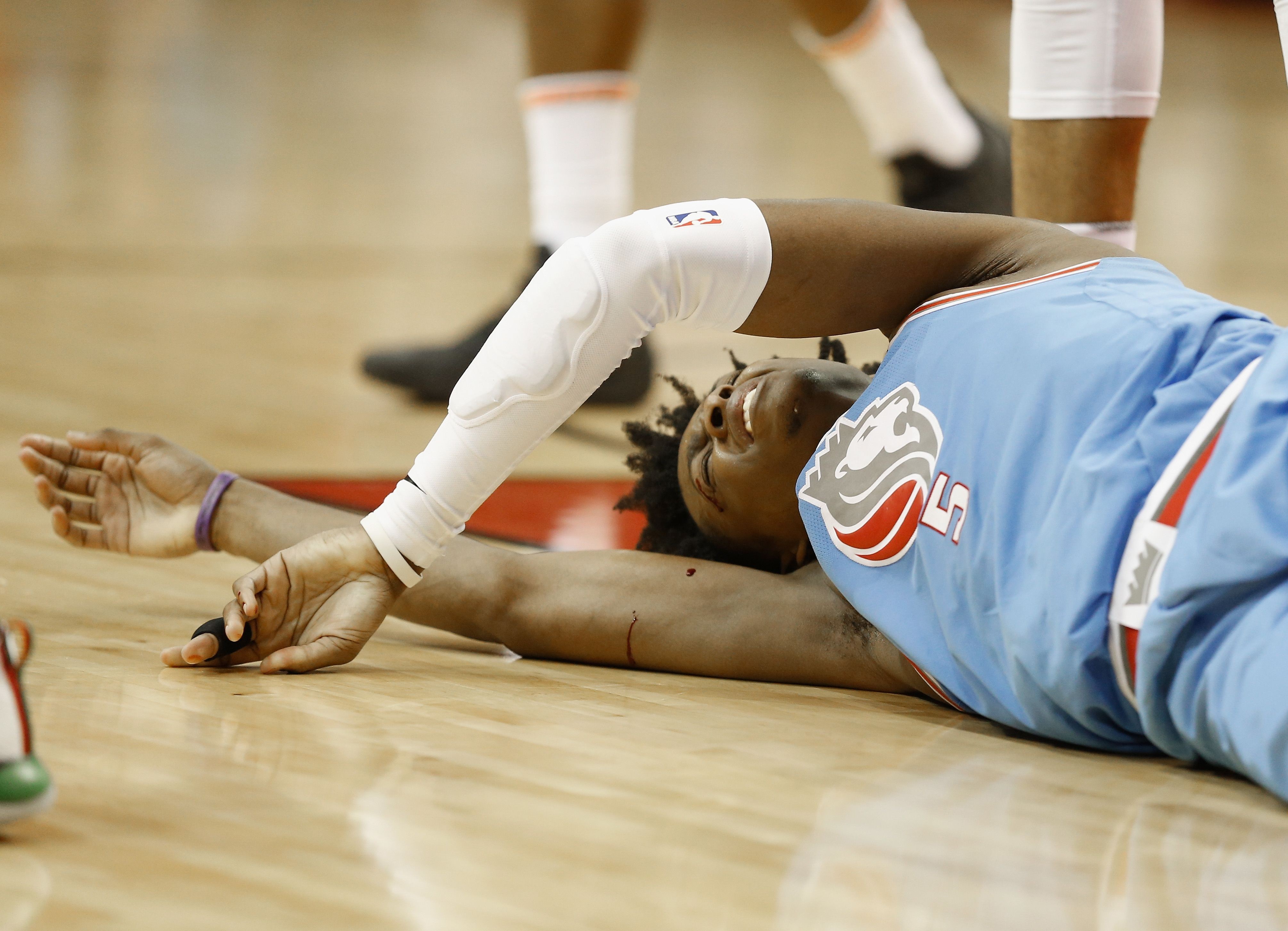 De’aaron Fox Leaves Game Against Houston With Head Injury