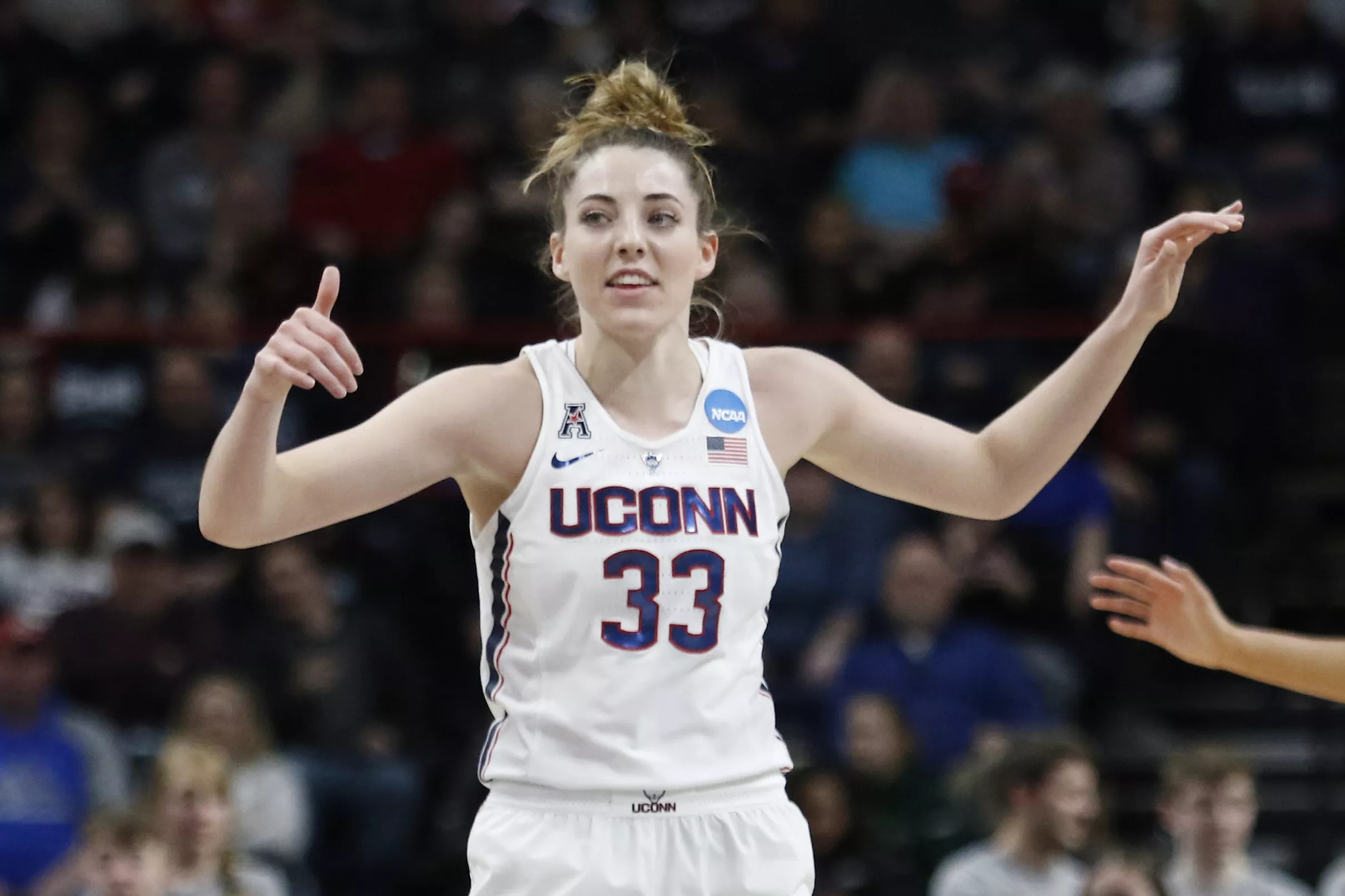 UConn Women’s Basketball Katie Lou Samuelson Undergoes Successful Left