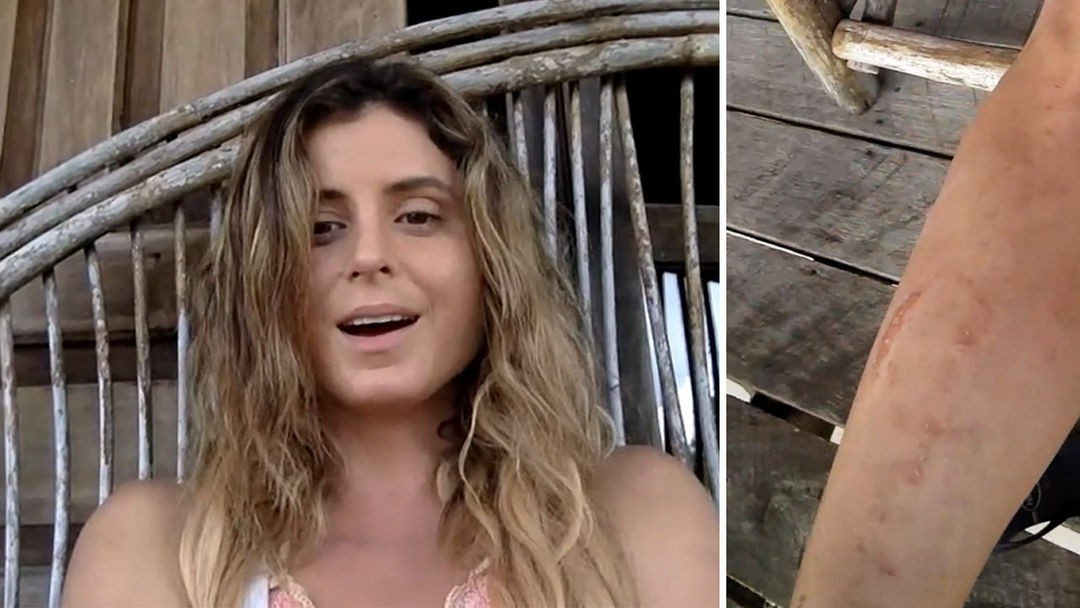 Anastasia Ashley Naked and Attacked by Sandflies! (VIDEO 