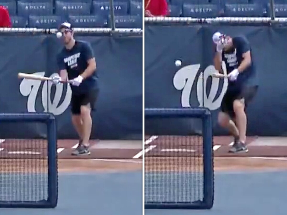 Breaks Nose Bunting In Batting Practice