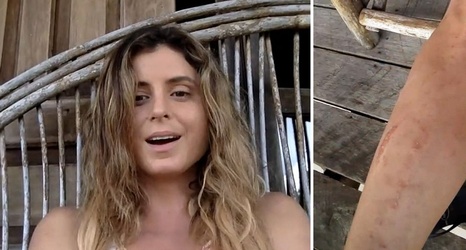 Surfer Anastasia Ashley Got Attacked By - One News Page VIDEO